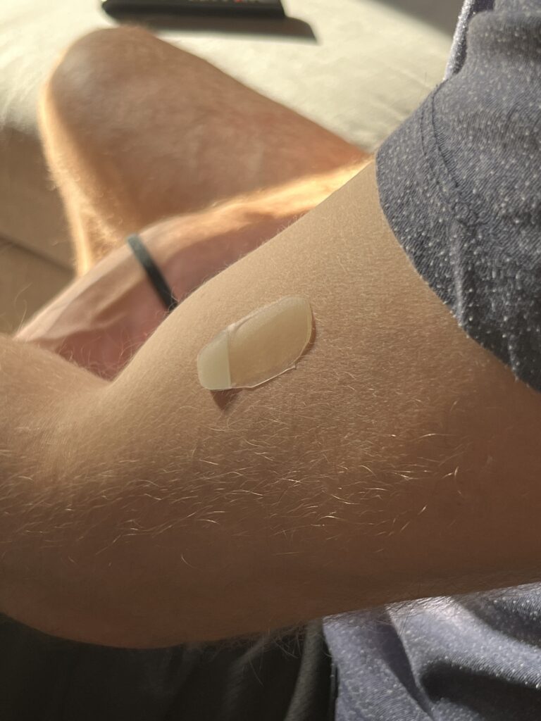 The patch is worn for 24 hours to collect interstitial fluid and give a daily average of kidney function.